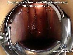 AlexExtreme Incredible deep anal view XO speculum & light in Hotkikyjo ass