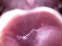 Japanese endoscope throat deep